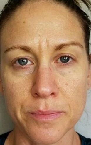 By the age of 40, deep wrinkles and age spots appeared