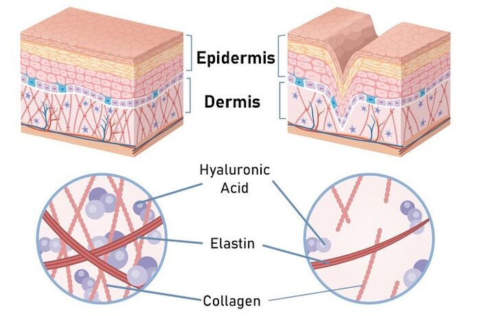 Simpla 360 stimulates collagen synthesis
