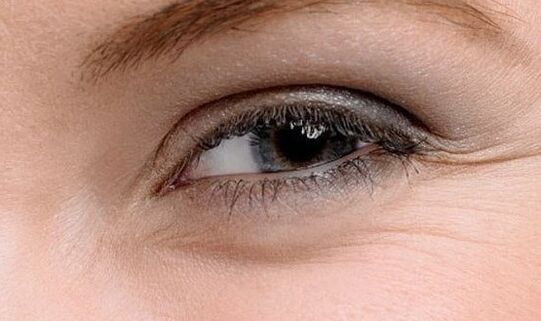 Wrinkles in the corners of the eyes